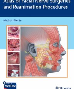 Atlas of Facial Nerve Surgeries and Reanimation Procedures (Original PDF from Publisher)