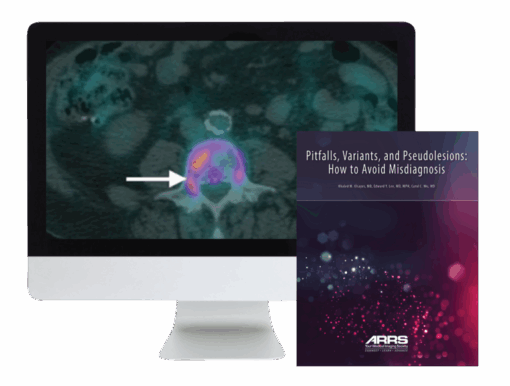 ARRS Pitfalls, Variants, and Pseudolesions: How to Avoid Misdiagnosis 2019 (CME VIDEOS)