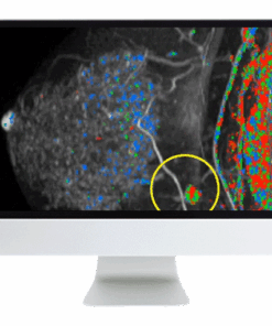 Breast Imaging Pearls and Pitfalls: Traditional and Novel Imaging Approaches 2020 (CME VIDEOS)