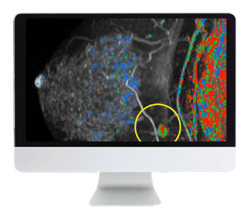Breast Imaging Pearls and Pitfalls: Traditional and Novel Imaging Approaches 2020 (CME VIDEOS)