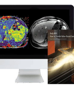 Body MRI: How to Provide Value-Based Care 2018 (ARRS VIDEOS) (CME VIDEOS)