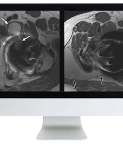 ARRS Controversies in Hip and Pelvis Imaging 2016 (CME VIDEOS)