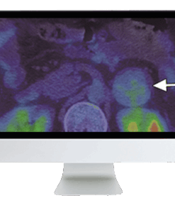 Breakthroughs in Nuclear Medicine for Neurology and Oncology 2021 (CME VIDEOS)