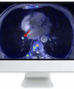 Applying Recent Advances in PET to Clinical Practice 2020 (CME VIDEOS)