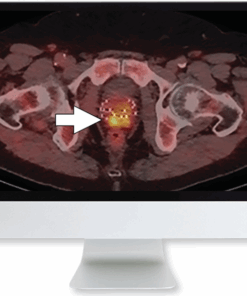 Molecular Imaging and Therapy of Prostate Cancer 2020 (CME VIDEOS)