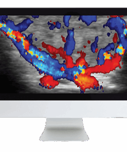 ARRS Thyroid Imaging 2019 (CME VIDEOS)