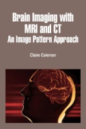 Brain Imaging with MRI and CT: An Image Pattern Approach (PDF) 2019