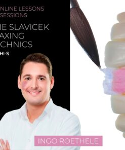 Diagnostic wax-up in the concept of Dr. Slavicek!  