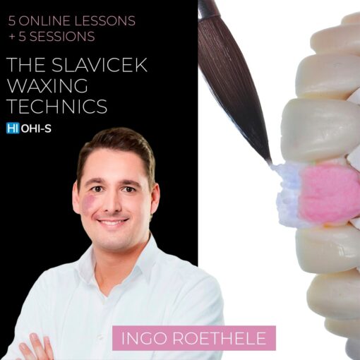 Diagnostic wax-up in the concept of Dr. Slavicek!  