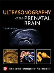 Ultrasonography of the Prenatal Brain, Third Edition pdf