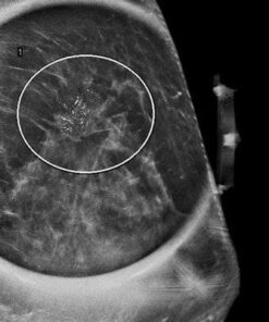Imaging Mastery Series: High Risk Screening Breast MRI 2021 cme videos