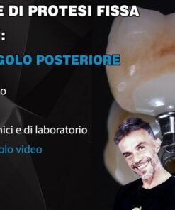 Corso Base di Protesi Fissa su Impianti, Il Dente Singolo Posteriore