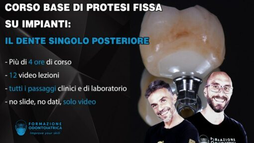 Corso Base di Protesi Fissa su Impianti, Il Dente Singolo Posteriore