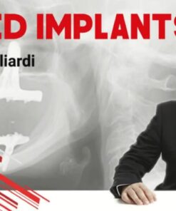 Tilted Implants - Enrico Agliardi (Italiano)