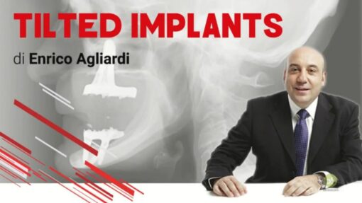 Tilted Implants - Enrico Agliardi (Italiano)