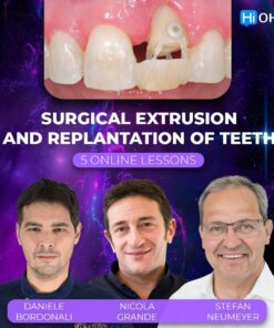 OHI-S Surgical Extrusion and Replantation of Teeth
