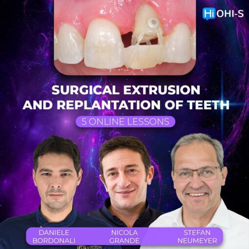 OHI-S Surgical Extrusion and Replantation of Teeth