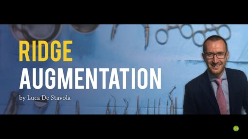 Ridge Augmentation - Luca De Stavola  (italiano) 
