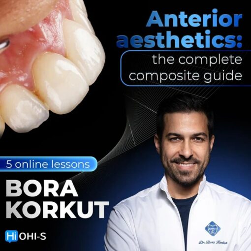 OHI-S Anterior Aesthetics: The Complete Composite Guide - Bora Korkut
