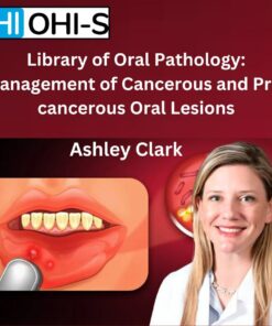 OHI-S - Library of Oral Pathology: Management of Cancerous and Precancerous Oral Lesions