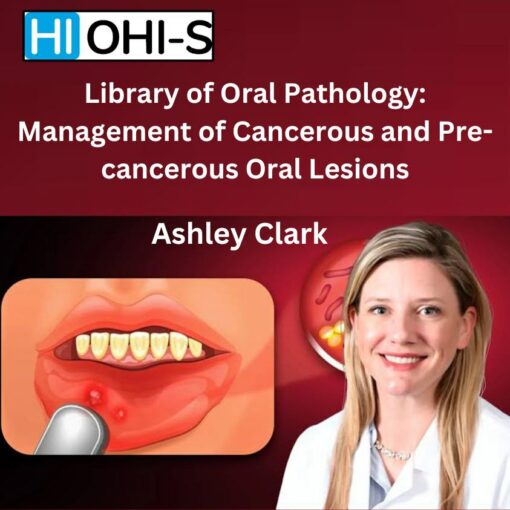 OHI-S - Library of Oral Pathology: Management of Cancerous and Precancerous Oral Lesions