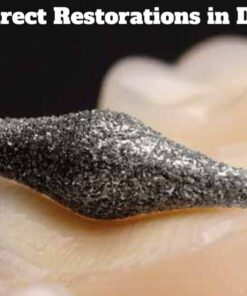 Indirect Restorations in Dentistry - A Complete Guide