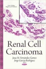 Renal Cell Carcinoma