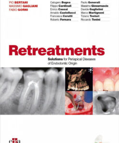 Retreatments: Solutions for Periapical Diseases of Endodontic Origin PDF