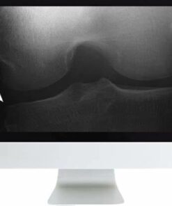 Musculoskeletal Imaging for the Practicing Radiologist