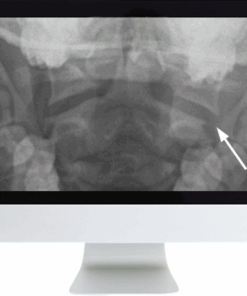 Neuroradiology Review for the Practicing Radiologist