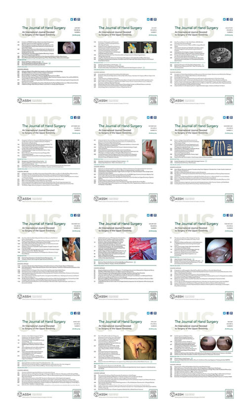 The Journal of Hand Surgery 2021 Full Archives (True PDF)