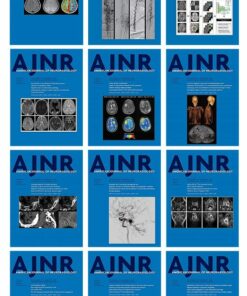 American journal of Neuroradiology 2022 Full Archives (True PDF)