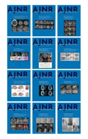 American journal of Neuroradiology 2021 Full Archives  True PDF