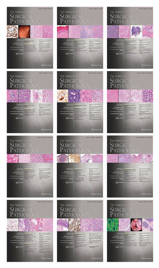 American Journal of Surgical Pathology 2022 Full Archives (True PDF)
