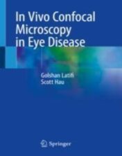 In Vivo Confocal Microscopy in Eye Disease 2022 original pdf