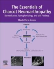 The Essentials of Charcot Neuroarthropathy: Biomechanics, Pathophysiology, and MRI Findings 2022 Original PDF