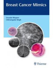 Breast Cancer Mimics 2020  Original PDF