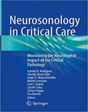 Neurosonology in Critical Care: Monitoring the Neurological Impact of the Critical Pathology 2022 Original PDF