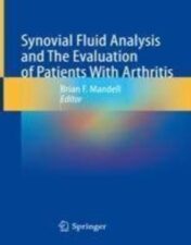 Synovial Fluid Analysis and The Evaluation of Patients With Arthritis 2022 Original pdf