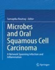 Microbes and Oral Squamous Cell Carcinoma: A Network Spanning Infection and Inflammation 2022 Original pdf