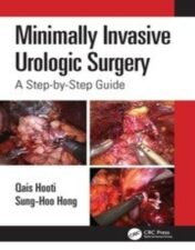 Minimally Invasive Urologic Surgery A Step-by-Step Guide 2022 Original pdf