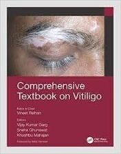 Comprehensive Textbook on Vitiligo 2022 Original pdf