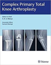 Complex Primary Total Knee Arthroplasty 2017 Original PDF