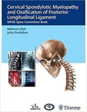 Cervical Spondylotic Myelopathy and Ossification of Posterior Longitudinal Ligament 2021 Original PDF